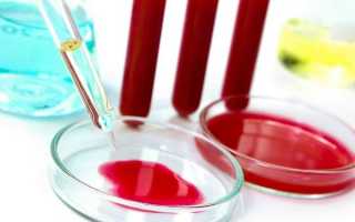Какие виды анализов крови на паразитов самые эффективные?