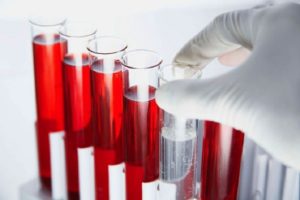 Анализ крови для выявления антител к токсокарам thumbnail
