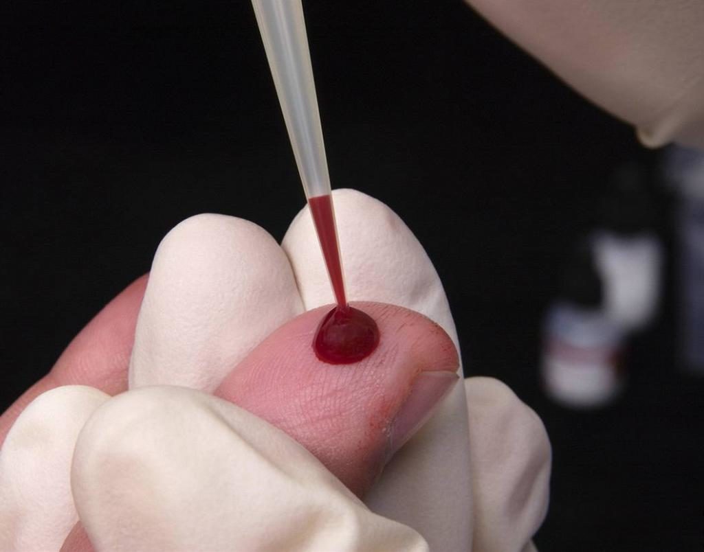 Как правильно сдать анализ крови на аскариды thumbnail