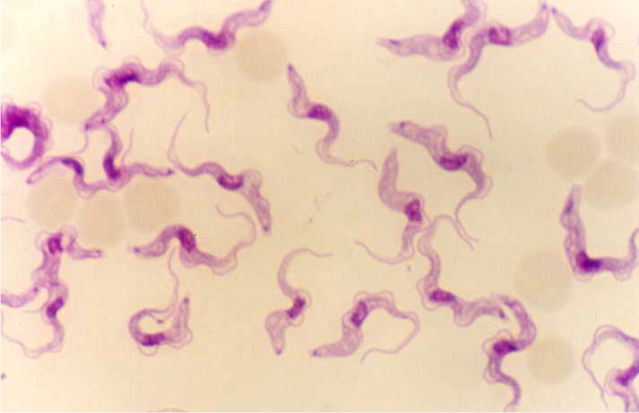 Trypanosoma brucei rhodesiense 
