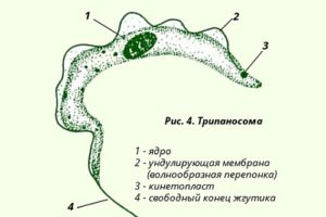 Сонная болезнь фото